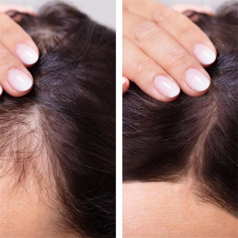 2023 Biotin Fast Hair Growth O - Licorice Root Sticks review and price